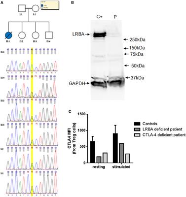 Evaluating the Genetics of Common Variable Immunodeficiency: Monogenetic Model and Beyond